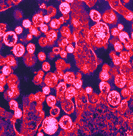 Marburg_virus_0.99870455.JPEG