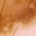 ISIC_0052349_crop51.png