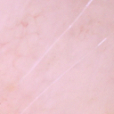 ISIC_0058510_crop11.png