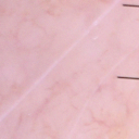 ISIC_0058510_crop12.png