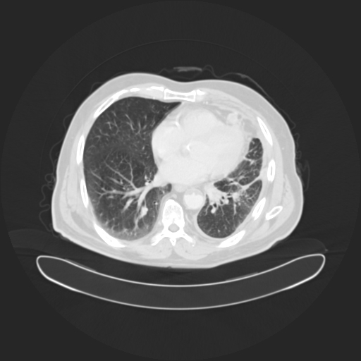 Malignant_case_1.jpg